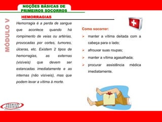 HEMORRAGIAS
Hemorragia é a perda de sangue
que acontece quando há
rompimento de veias ou artérias,
provocadas por cortes, tumores,
úlceras, etc. Existem 2 tipos de
hemorragias, as externas
(visíveis) que devem ser
estancadas imediatamente e as
internas (não visíveis), mas que
podem levar a vítima à morte.
Como socorrer:
 manter a vítima deitada com a
cabeça para o lado;
 afrouxar suas roupas;
 manter a vítima agasalhada;
 procurar assistência médica
imediatamente.
MÓDULOV NOÇÕES BÁSICAS DE
PRIMEIROS SOCORROS
 