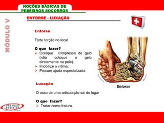 Entorse
Forte torção no local
O que fazer?
 Coloque compressa de gelo
(não coloque o gelo
diretamente na pele).
 Imobilize a vítima;
 Procure ajuda especializada.
Luxação
O osso de uma articulação sai do lugar
O que fazer?
 Tratar como fratura.
Entorse
ENTORSE - LUXAÇÃO
MÓDULOV NOÇÕES BÁSICAS DE
PRIMEIROS SOCORROS
 
