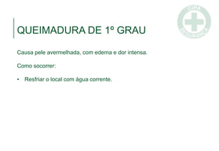 QUEIMADURA DE 1º GRAU
Causa pele avermelhada, com edema e dor intensa.
Como socorrer:
• Resfriar o local com água corrente.
 