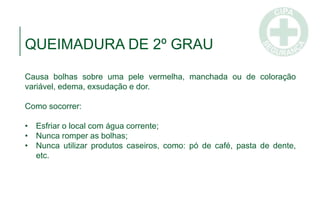 QUEIMADURA DE 2º GRAU
Causa bolhas sobre uma pele vermelha, manchada ou de coloração
variável, edema, exsudação e dor.
Como socorrer:
• Esfriar o local com água corrente;
• Nunca romper as bolhas;
• Nunca utilizar produtos caseiros, como: pó de café, pasta de dente,
etc.
 