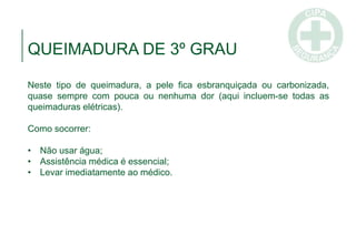 QUEIMADURA DE 3º GRAU
Neste tipo de queimadura, a pele fica esbranquiçada ou carbonizada,
quase sempre com pouca ou nenhuma dor (aqui incluem-se todas as
queimaduras elétricas).
Como socorrer:
• Não usar água;
• Assistência médica é essencial;
• Levar imediatamente ao médico.
 