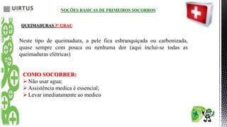 NOÇÕES BÁSICAS DE PRIMEIROS SOCORROS
QUEIMADURAS 3° GRAU
Neste tipo de queimadura, a pele fica esbranquiçada ou carbonizada,
quase sempre com pouca ou nenhuma dor (aqui inclui-se todas as
queimaduras elétricas)
COMO SOCORRER:
Não usar agua;
Assistência medica é essencial;
Levar imediatamente ao medico
 
