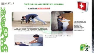 NOÇÕES BÁSICAS DE PRIMEIROS SOCORROS
MANOBRA DE HEIMLICH
 