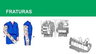 FRATURAS
 