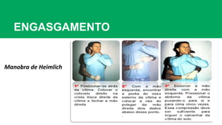 ENGASGAMENTO
Manobra de Heimlich
 