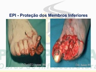 EPI - Proteção dos Membros Inferiores
 