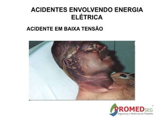 ACIDENTE EM BAIXA TENSÃO
ACIDENTES ENVOLVENDO ENERGIA
ELÉTRICA
 