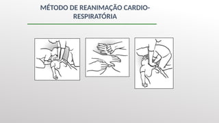 MÉTODO DE REANIMAÇÃO CARDIO-
RESPIRATÓRIA
 
