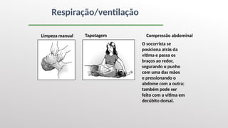 Respiração/ventilação
O socorrista se
posiciona atrás da
vítima e passa os
braços ao redor,
segurando o punho
com uma das mãos
e pressionando o
abdome com a outra;
também pode ser
feito com a vítima em
decúbito dorsal.
Compressão abdominal
Tapotagem
Limpeza manual
 