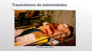 Traumatismo de extremidades
 