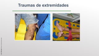 Traumas de extremidades
©
SST
TITÃS
2023.
Todos
os
Direitos
Reservados
 
