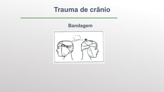 Trauma de crânio
Bandagem
 