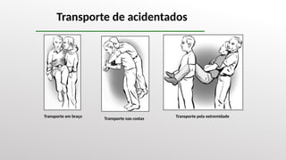 Transporte de acidentados
Transporte pela extremidade
Transporte nas costas
Transporte em braço
 