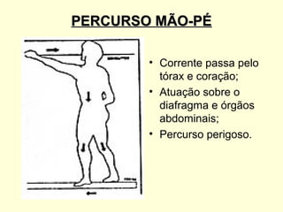 PERCURSO MÃO-PÉ

        • Corrente passa pelo
          tórax e coração;
        • Atuação sobre o
          diafragma e órgãos
          abdominais;
        • Percurso perigoso.
 