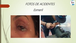 FOTOS DE ACIDENTES
Esmeril
 