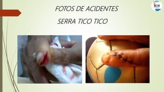 FOTOS DE ACIDENTES
SERRA TICO TICO
 