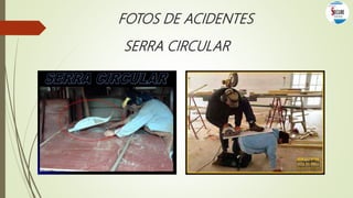 FOTOS DE ACIDENTES
SERRA CIRCULAR
 