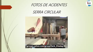 FOTOS DE ACIDENTES
SERRA CIRCULAR
 