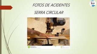 FOTOS DE ACIDENTES
SERRA CIRCULAR
 
