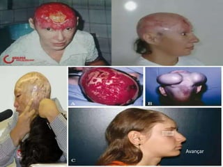 Avançar
19/06/2012             22
 