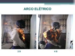 ARCO ELÉTRICO
2 S 4 S
 
