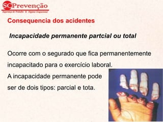 Consequencia dos acidentes
Incapacidade permanente partcial ou total
Ocorre com o segurado que fica permanentemente
incapacitado para o exercício laboral.
A incapacidade permanente pode
ser de dois tipos: parcial e tota.
29
 