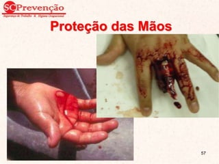 Proteção das Mãos
57
 