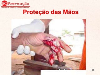Proteção das Mãos
58
 