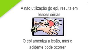 2020 SMALLSTORE. Todos os Direitos Reservados. Siga-nos!
31
A não utilização do epi, resulta em
lesões sérias
O epi ameniza a lesão, mas o
acidente pode ocorrer
 