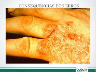 CONSEQUÊNCIAS DOS ERROS
 