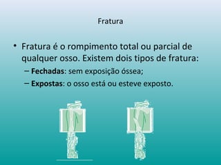 Fratura
• Fratura é o rompimento total ou parcial de
qualquer osso. Existem dois tipos de fratura:
– Fechadas: sem exposição óssea;
– Expostas: o osso está ou esteve exposto.
 