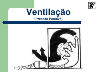 Ventilação
(Pressão Positiva)
 