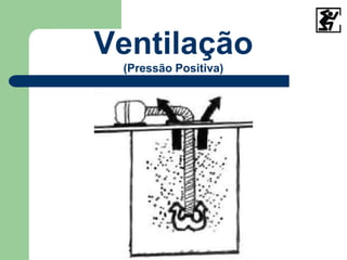 Ventilação
(Pressão Positiva)
 