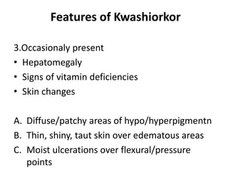 Features of Kwashiorkor
3.Occasionaly present
• Hepatomegaly
• Signs of vitamin deficiencies
• Skin changes
A. Diffuse/patchy areas of hypo/hyperpigmentn
B. Thin, shiny, taut skin over edematous areas
C. Moist ulcerations over flexural/pressure
points
 