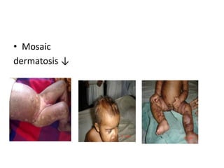 • Mosaic
dermatosis ↓
 