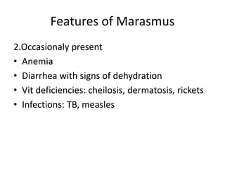 Features of Marasmus
2.Occasionaly present
• Anemia
• Diarrhea with signs of dehydration
• Vit deficiencies: cheilosis, dermatosis, rickets
• Infections: TB, measles
 