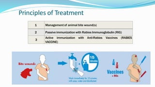 Principles of Treatment
1 Management of animal bite wound(s)
2 Passive immunization with Rabies Immunoglobulin (RIG)
3
Active immunization with Anti-Rabies Vaccines (RABIES
VACCINE)
 