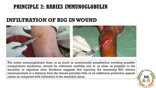 Infiltration Injection Rabies Rabies,NRCP, Rabies Guidline - Dr Himanshu Kaushik.pptx