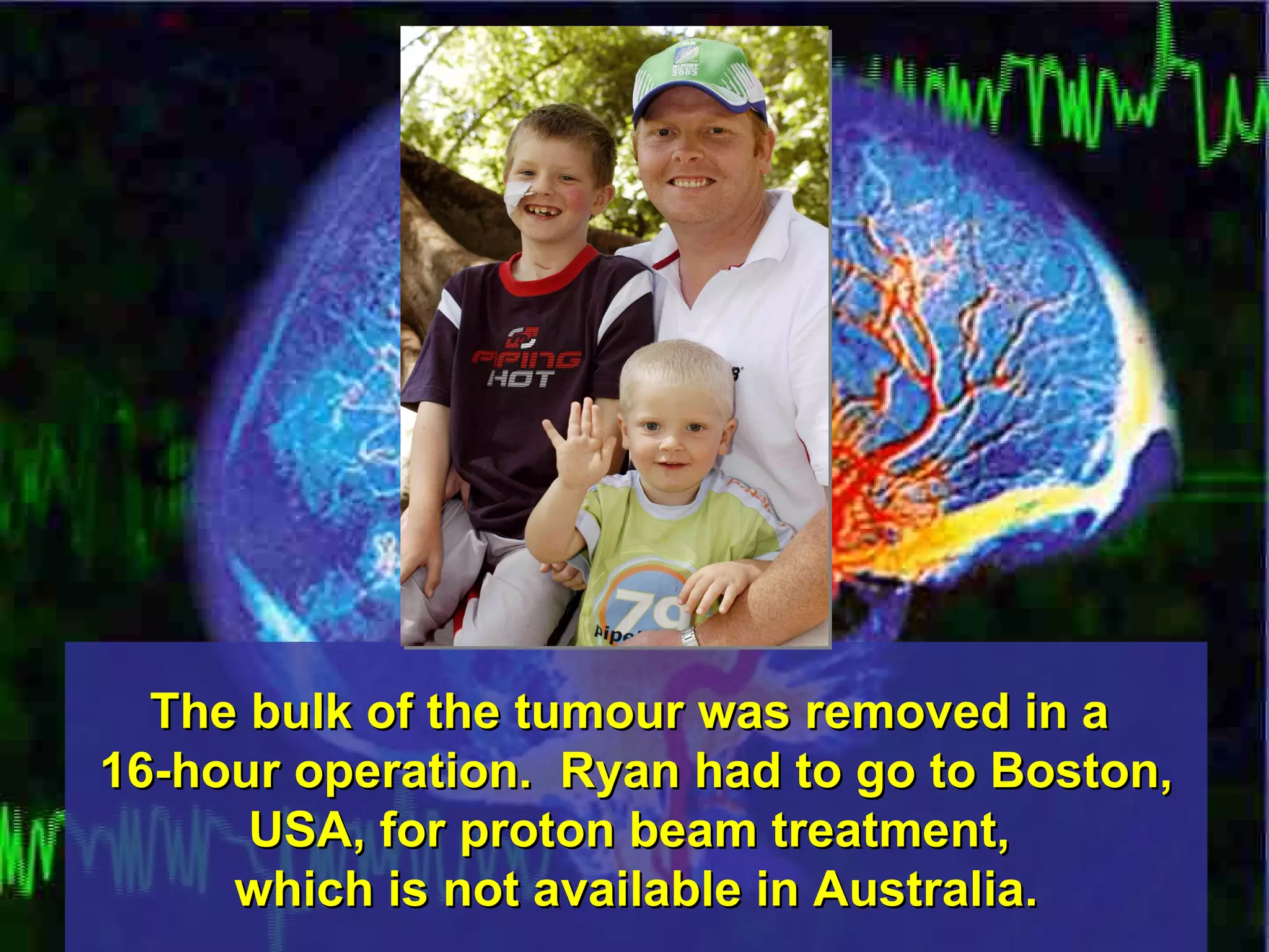 The bulk of the tumour was removed in a  16-hour operation.  Ryan had to go to Boston, USA, for proton beam treatment,  which is not available in Australia. 