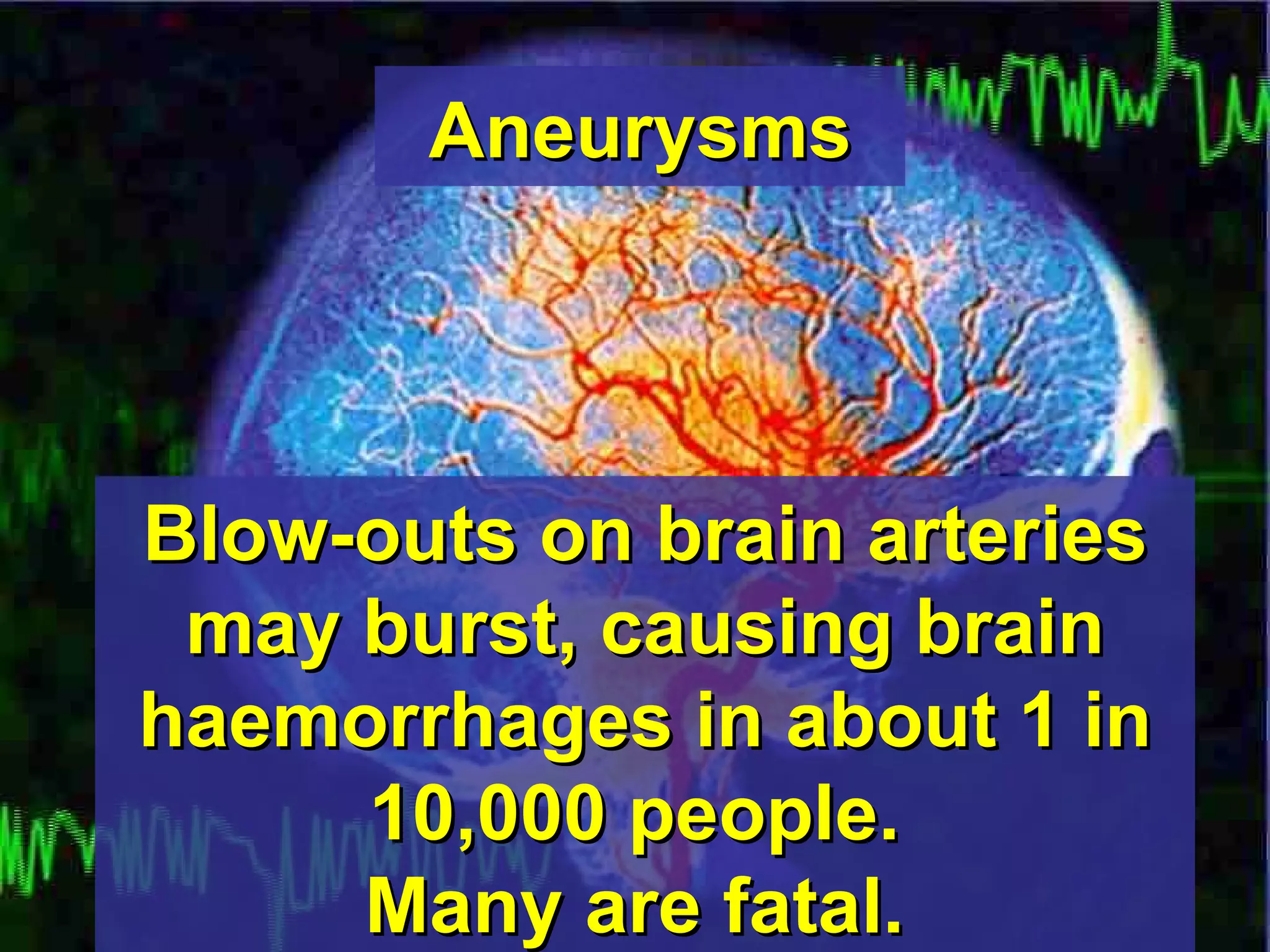 Aneurysms Blow-outs on brain arteries may burst, causing brain haemorrhages in about 1 in 10,000 people.  Many are fatal.   