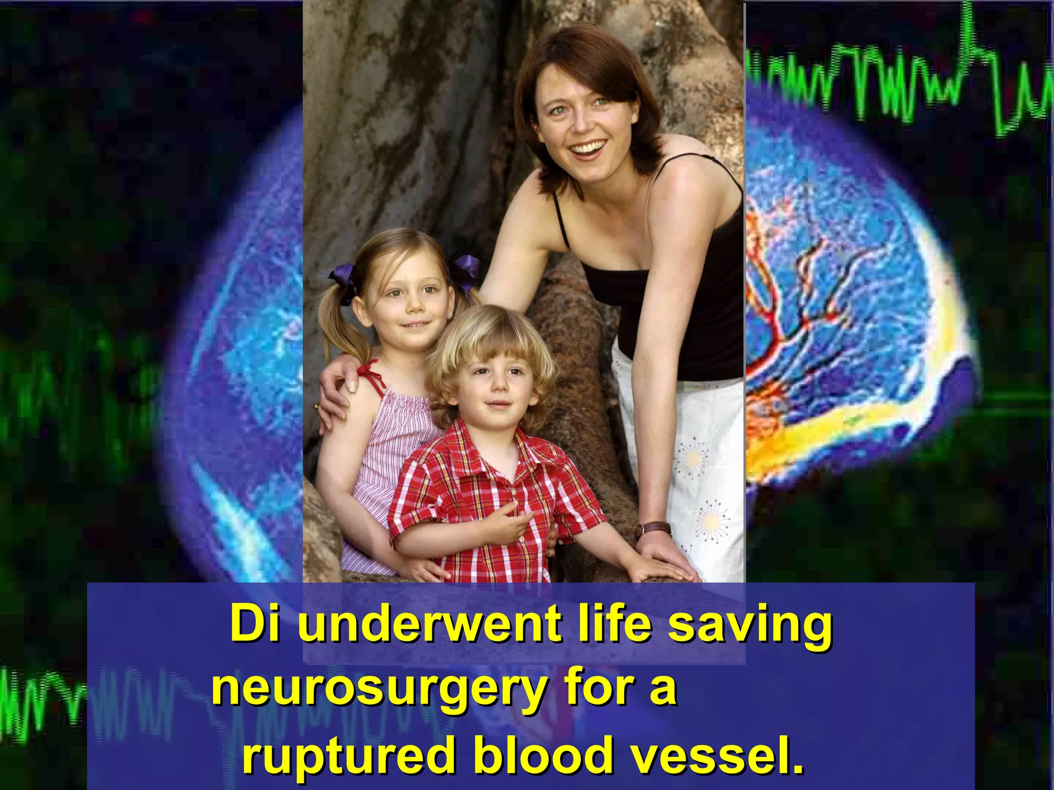 Di underwent life saving neurosurgery for a  ruptured blood vessel.   