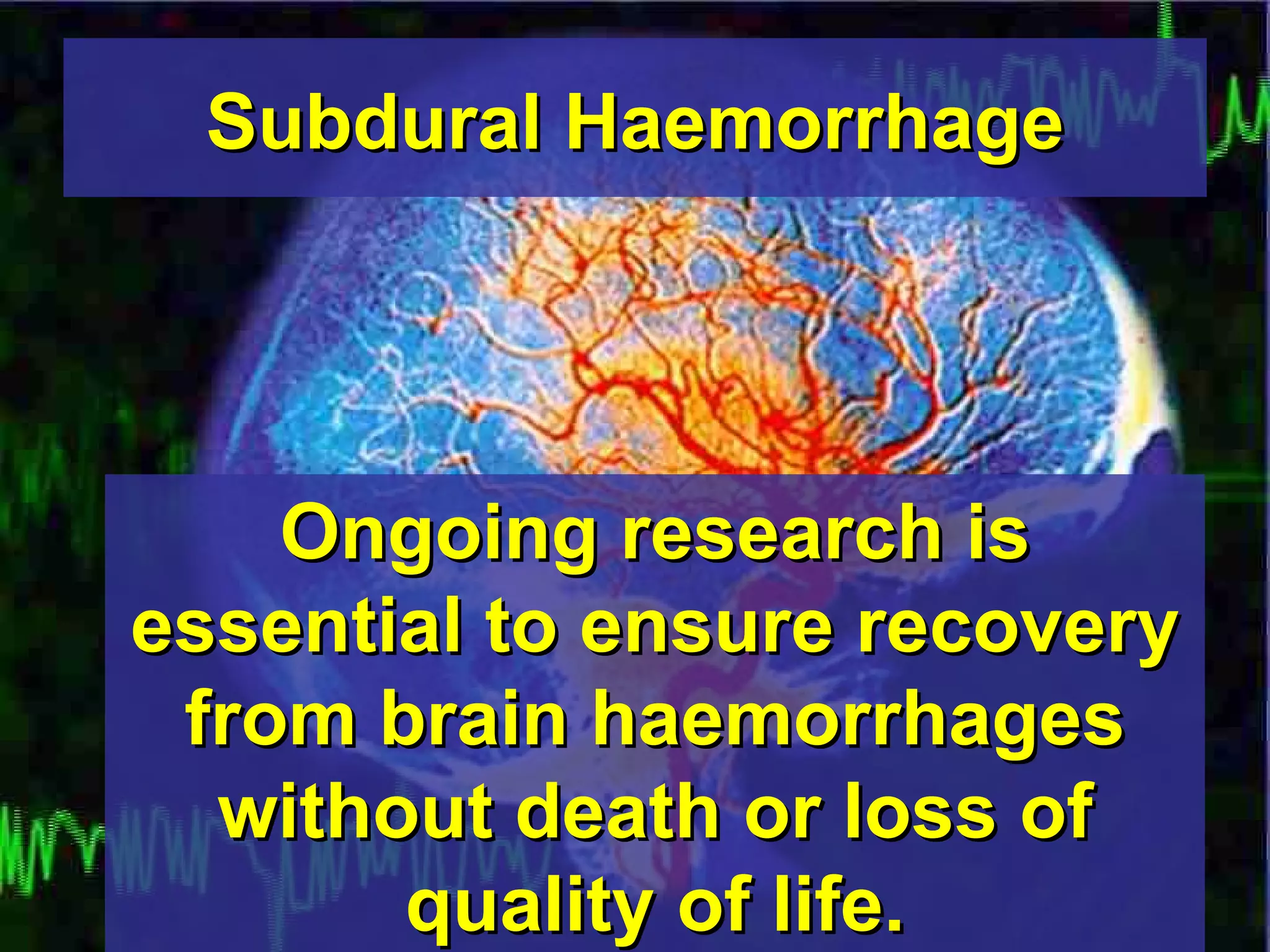 Subdural Haemorrhage Ongoing research is essential to ensure recovery from brain haemorrhages without death or loss of quality of life. 