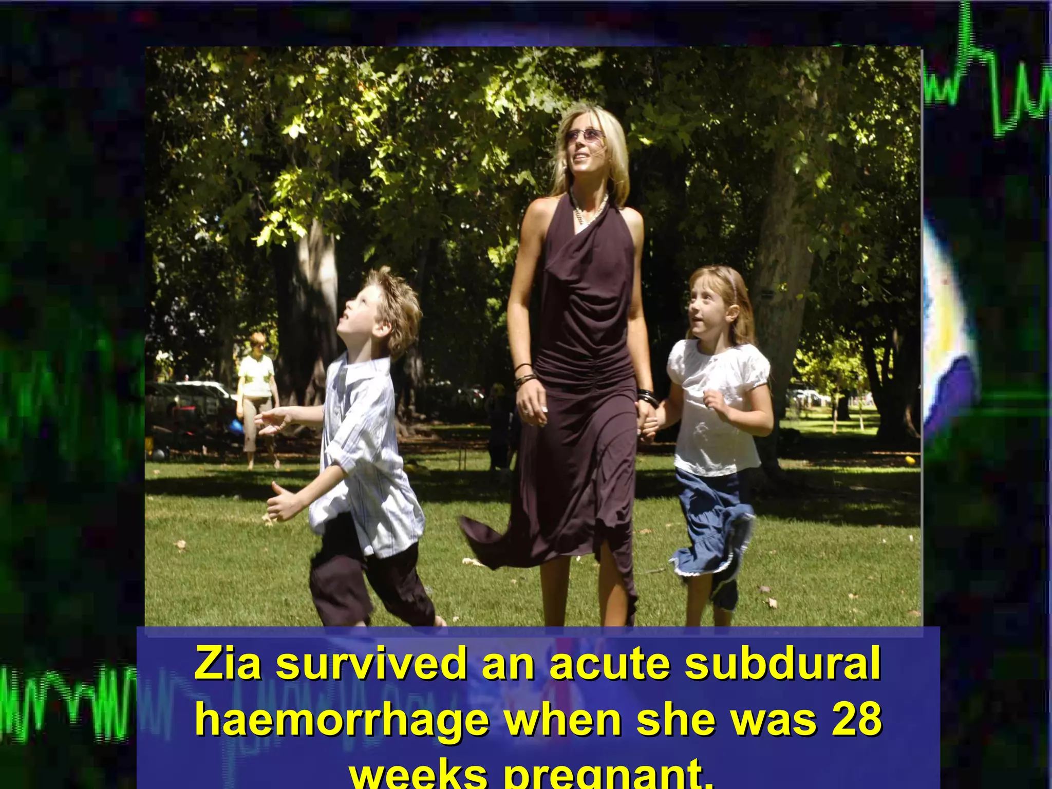 Zia survived an acute subdural haemorrhage when she was 28 weeks pregnant.  