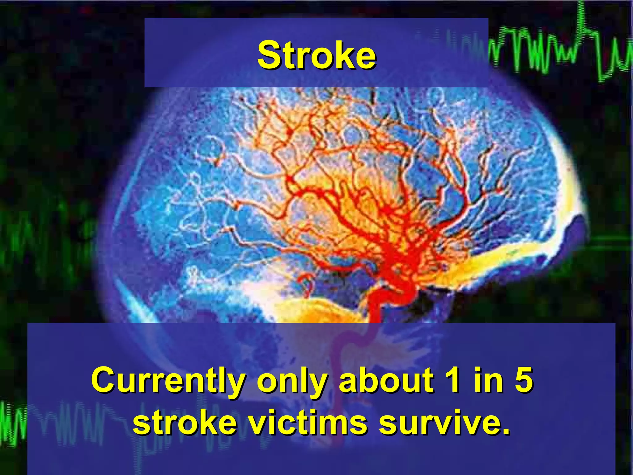 Stroke Currently only about 1 in 5  stroke victims survive. 
