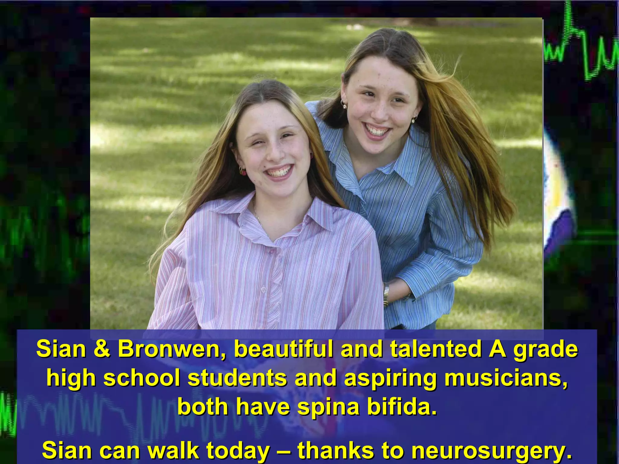 Sian & Bronwen, beautiful and talented A grade high school students and aspiring musicians, both have spina bifida. Sian can walk today – thanks to neurosurgery. 