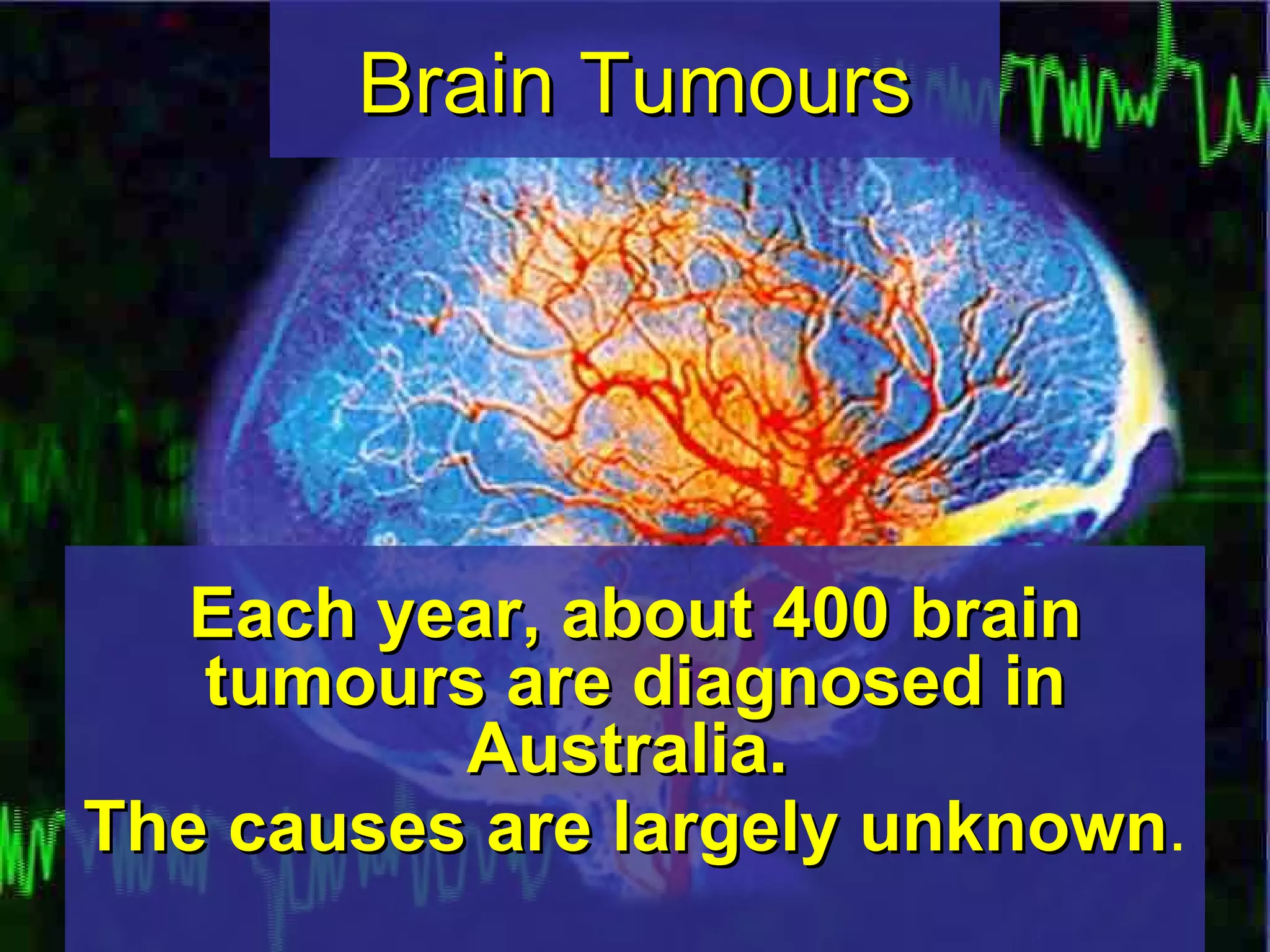Brain Tumours Each year, about 400 brain   tumours are diagnosed in   Australia.   The causes are largely unknown .   