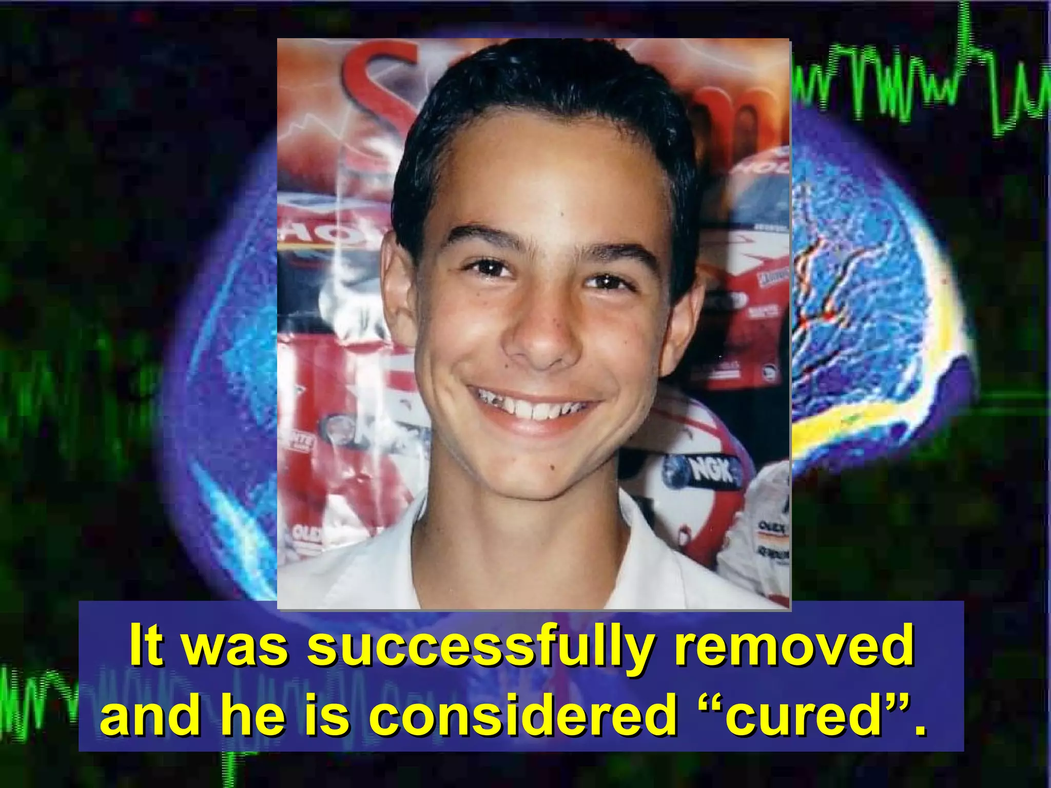 It was successfully removed and he is considered “cured”.   