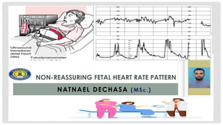 NON-REASSURING FETAL HEART RATE PATTERN
NATNAEL DECHASA (MSc . )
 