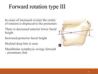 Growth Rotation NR | PPTX