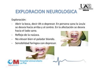 Exploración: 
‐  Abrir la boca, decir Ah o depresor. En persona sana la úvula 
   se desvia hacia arriba y al centro. En la afectación se desvia 
   hacia el lado sano. 
‐  Reﬂejo de la naúsea. 
‐  No elevan bien el paladar blando. 
‐  Sensibilidad faríngea con depresor. 
 